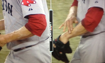 clay-buchholz-forearm.jpg